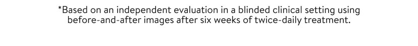 *Based on an independent evaluation in a blinded clinical setting using before-and-after images after six weeks of twice-daily treatment.
