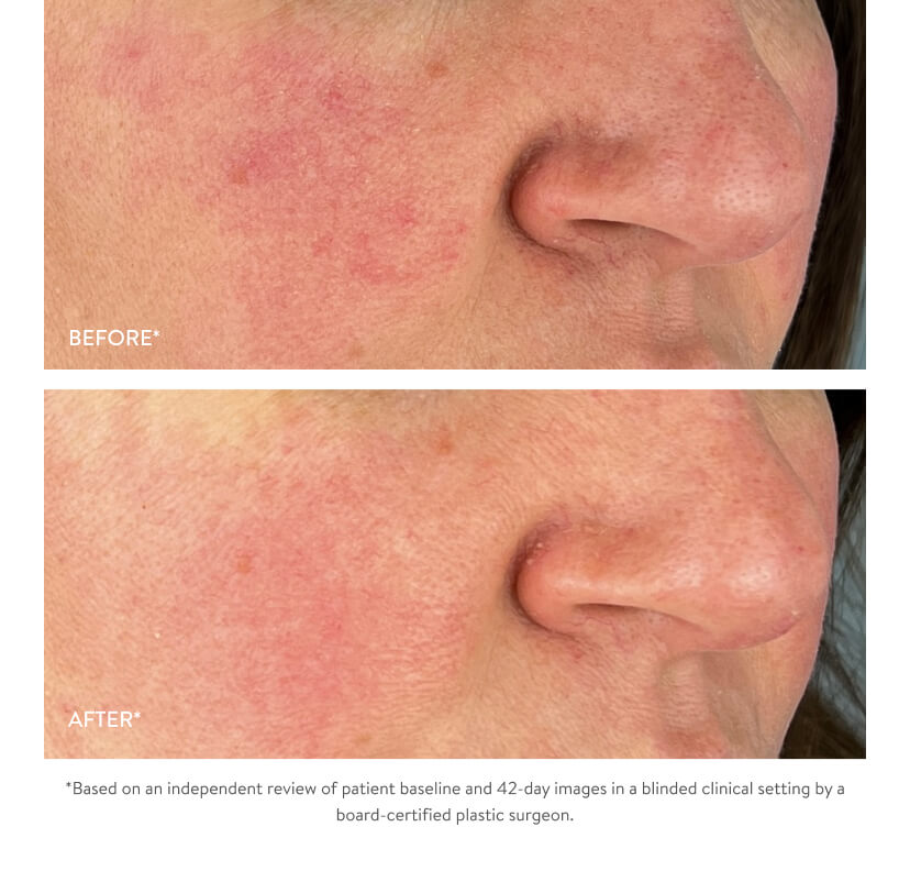 Before & After